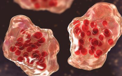 Have Measles Returned?  What everyone should know!