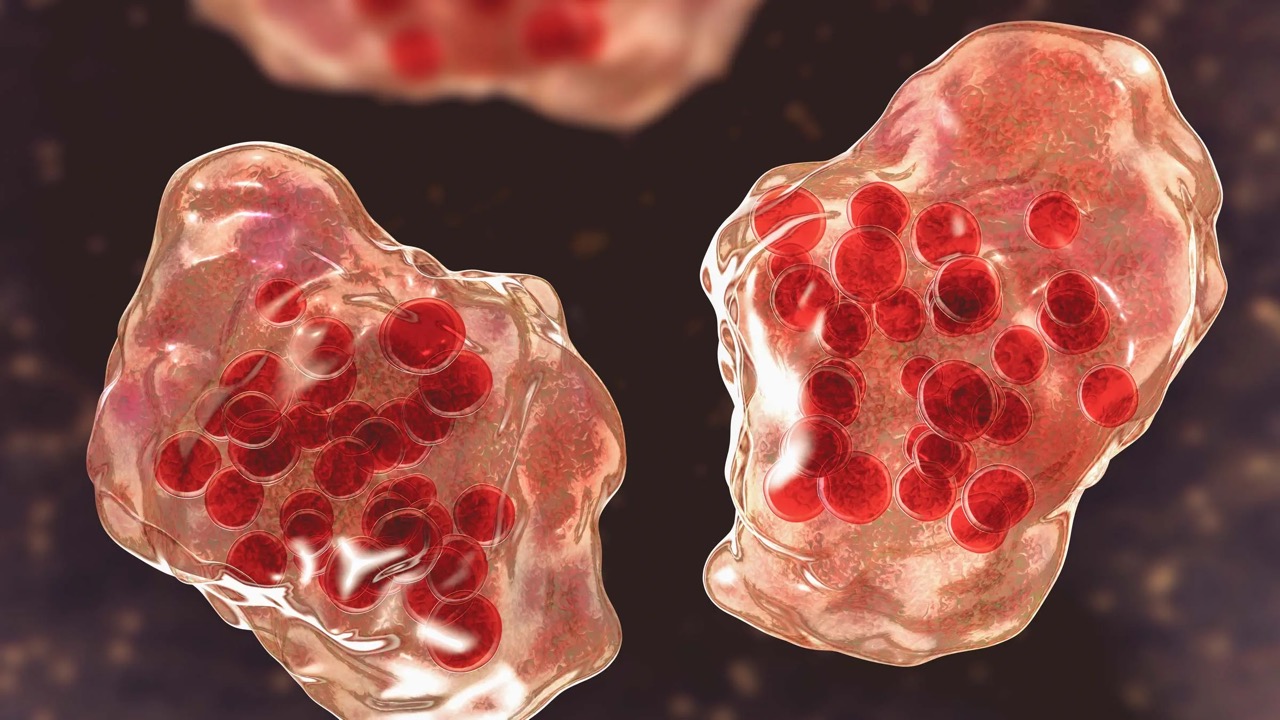 Have Measles Returned?  What everyone should know!