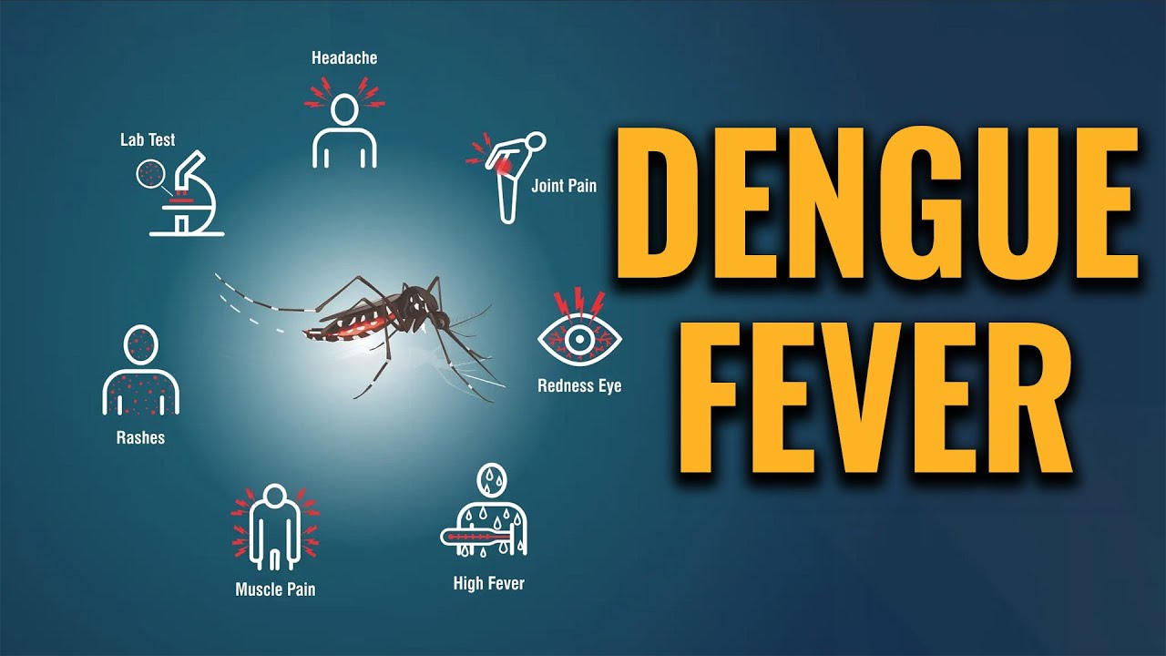 Dengue Fever