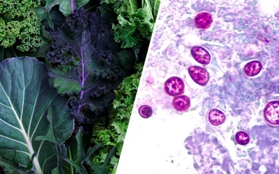 What is Cyclosporiasis?