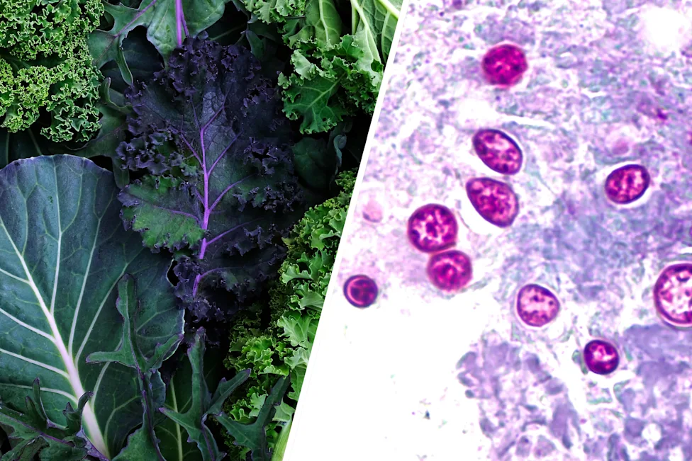 What is Cyclosporiasis?